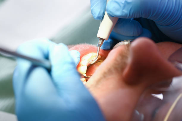 Best Emergency Dental Surgery in Double Oak, TX