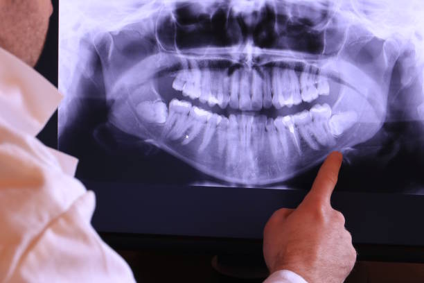 Best Walk-In Emergency Dentist in Double Oak, TX