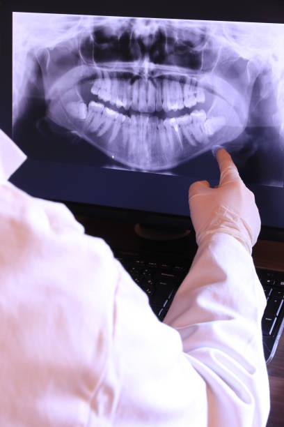 Best Emergency Root Canal Treatment in Double Oak, TX