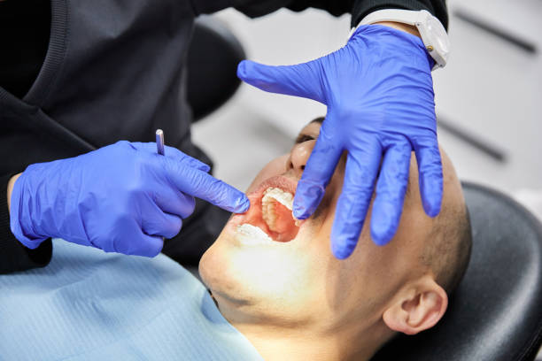 Best Emergency Tooth Extraction in Double Oak, TX